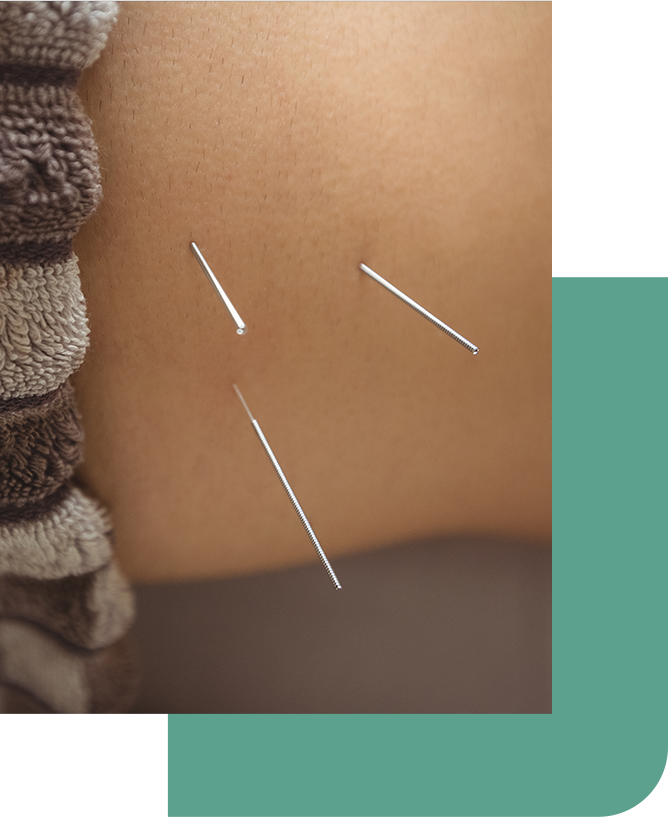tailored acupuncture treatment