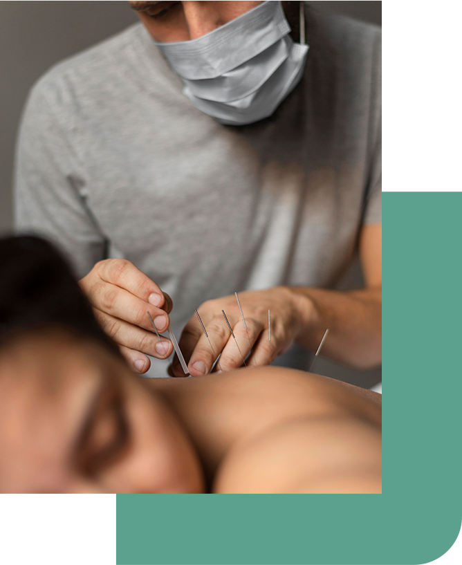 Acupuncture Treatment in Denver