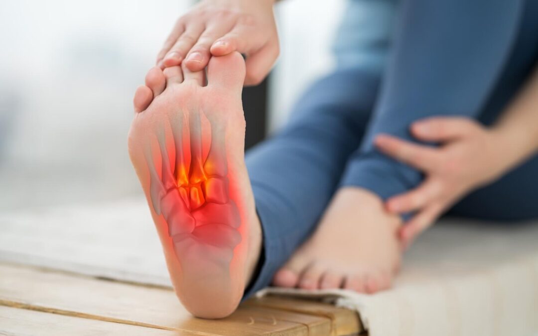 Can a Chiropractor Help with Plantar Fasciitis?