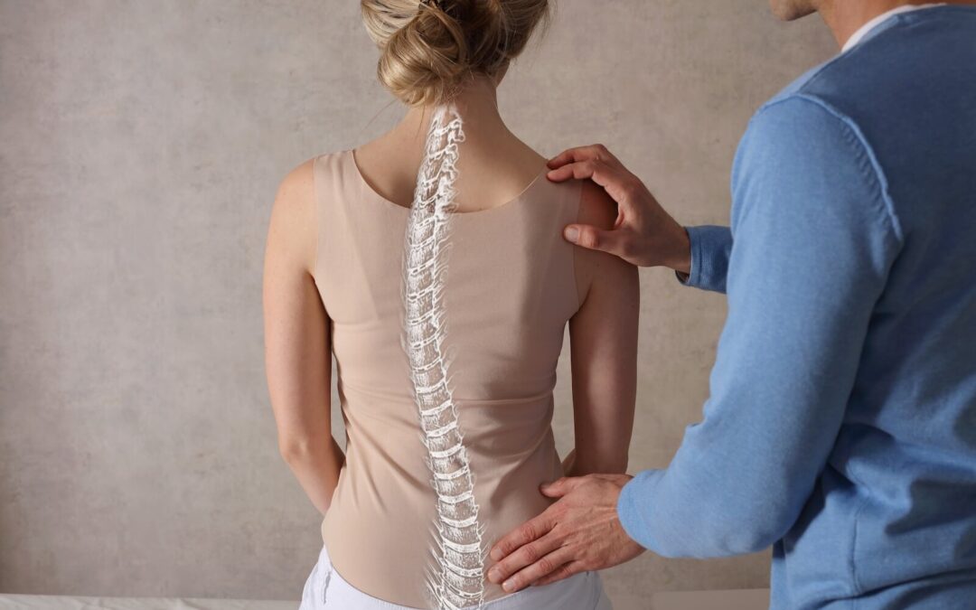 Can Chiropractors Treat Scoliosis?